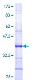 SDS-PAGE (CD6-0839H).jpg